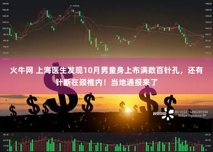 火牛网 上海医生发现10月男童身上布满数百针孔，还有针断在颈椎内！当地通报来了